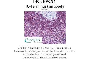 Image no. 1 for anti-Hydrogen Voltage-Gated Channel 1 (HVCN1) (C-Term) antibody (ABIN1735642) (HVCN1 antibody  (C-Term))