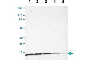Western Blot analysis of Lane 1: RT-4, Lane 2: U-251MG sp, Lane 3: A-431, Lane 4: human liver and Lane 5: human tonsil lysates with RPS20 polyclonal antibody .