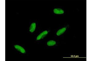 Immunofluorescence of purified MaxPab antibody to HIC2 on HepG2 cell. (HIC2 antibody  (AA 1-615))