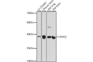 Western blot analysis of extracts of various cell lines, using GNAQ antibody (ABIN7267542) at 1:500 dilution. (GNAQ antibody  (AA 1-359))