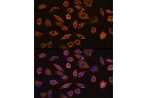 Immunofluorescence analysis of L929 cells using DOCK2 Rabbit pAb (ABIN1679578, ABIN5664348 and ABIN5664349) at dilution of 1:100 (40x lens). (DOCK2 antibody  (AA 1551-1830))