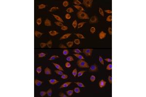 Immunofluorescence analysis of L929 cells using DOCK2 Rabbit pAb (ABIN1679578, ABIN5664348 and ABIN5664349) at dilution of 1:100 (40x lens). (DOCK2 antibody  (AA 1551-1830))