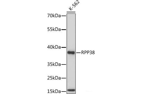 RPP38 antibody