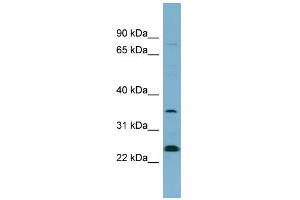 WB Suggested Anti-NOSIP Antibody Titration: 0. (NOSIP antibody  (N-Term))