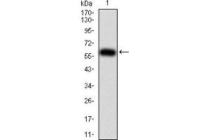 Western Blotting (WB) image for anti-Karyopherin alpha 2 (RAG Cohort 1, Importin alpha 1) (KPNA2) (AA 1-530) antibody (ABIN5921583) (KPNA2 antibody  (AA 1-530))