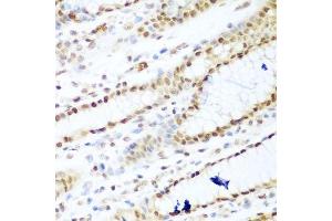 Immunohistochemistry of paraffin-embedded human stomach using HDAC1 antibody. (HDAC1 antibody  (AA 393-482))