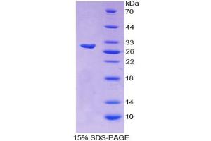 Image no. 1 for Zinc Finger Protein 384 (ZNF384) (AA 307-540) protein (His tag) (ABIN4988601)