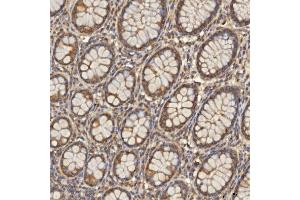 IHC analysis of TST using anti-TST antibody (ABIN7599105).