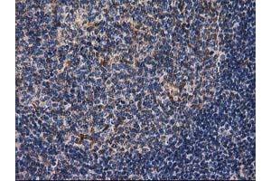 Image no. 15 for anti-Destrin (Actin Depolymerizing Factor) (DSTN) antibody (ABIN1497910) (Destrin antibody)