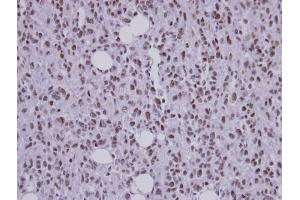 IHC-P Image Immunohistochemical analysis of paraffin-embedded Saos-2 xenograft, using SF3B3 , antibody at 1:100 dilution. (SF3B3 antibody  (C-Term))