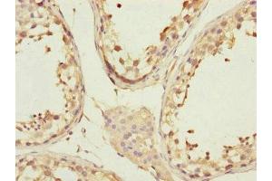 Immunohistochemistry of paraffin-embedded human testis tissue using ABIN7148058 at dilution of 1:100 (CCHCR1 antibody  (AA 483-782))