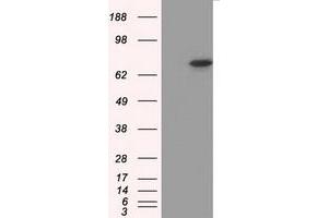 HEK293T cells were transfected with the pCMV6-ENTRY control (Left lane) or pCMV6-ENTRY PRKG1 (Right lane) cDNA for 48 hrs and lysed. (PRKG1 antibody)