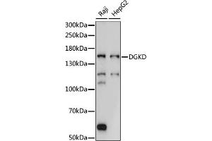 Western blot analysis of extracts of various cell lines, using DGKD antibody (ABIN7266748) at 1:1000 dilution. (DGKD antibody  (AA 960-1140))