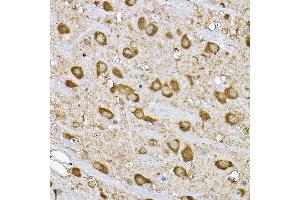 Immunohistochemistry (IHC) image for anti-Ribosomal Protein S6 Kinase, 70kDa, Polypeptide 1 (RPS6KB1) (AA 361-525) antibody (ABIN7270029)