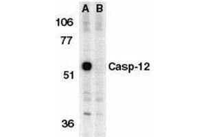Western blot analysis of Caspase-12 in mouse brain tissue lysate in the absence (A) or presence (B) of blocking peptide with Caspase-12 antibody at 1μg/ml. (Caspase 12 antibody  (AA 100-116))