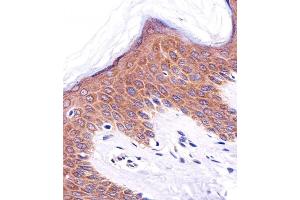 Immunohistochemical analysis of paraffin-embedded H. (ICT1 antibody  (C-Term))