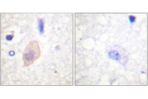 Immunohistochemistry (IHC) image for anti-Cell Division Cycle 25 Homolog B (S. Pombe) (CDC25B) (AA 319-368), (pSer353) antibody (ABIN1531551)