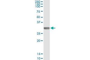 Immunoprecipitation of SNAI1 transfected lysate using anti-SNAI1 monoclonal antibody and Protein A Magnetic Bead , and immunoblotted with SNAI1 MaxPab rabbit polyclonal antibody. (SNAIL antibody  (AA 121-230))