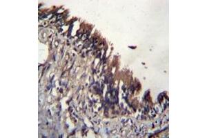 Immunohistochemistry analysis in formalin fixed and paraffin embedded human lung tissue reacted with NUDT9 / NUDT10 (C-term)  Antibody  followed by peroxidase conjugation of the secondary antibody and DAB staining. (NUDT9 antibody  (C-Term))