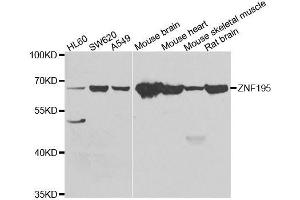 Western blot analysis of extracts of various cell lines, using ZNF195 antibody. (ZNF195 antibody  (AA 1-250))