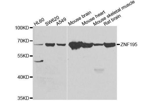 ZNF195 anticorps  (AA 1-250)