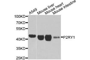 Western blot analysis of extracts of various cell lines, using P2RY1 antibody. (P2RY1 antibody  (AA 274-373))