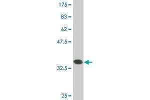 Western Blot detection against Immunogen (36. (RBM6 antibody  (AA 1024-1123))