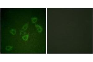 Immunofluorescence analysis of HuvEc cells, using Caspase 6 (Phospho-Ser257) Antibody. (Caspase 6 antibody  (pSer257))