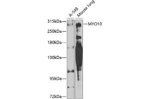 Western blot analysis of extracts of various cell lines, using MYO10 antibody (ABIN6128320, ABIN6144272, ABIN6144275 and ABIN6224500) at 1:1000 dilution. (Myosin X antibody  (AA 845-944))