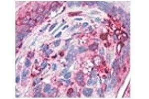 IHC testing of human stomach with AGR2 antibody at 4ug/ml. (AGR2 antibody  (N-Term))