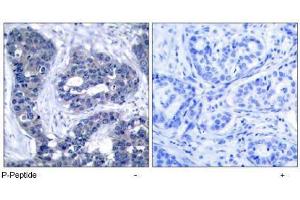 Image no. 1 for anti-Insulin Receptor Substrate 1 (IRS1) (pSer639) antibody (ABIN196981) (IRS1 antibody  (pSer639))