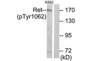 Western Blotting (WB) image for anti-Ret Proto-Oncogene (RET) (pTyr1062) antibody (ABIN2888523) (Ret Proto-Oncogene antibody  (pTyr1062))