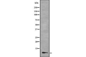 Western blot analysis of MLLT11 using COLO205 whole cell lysates (MLLT11 antibody  (N-Term))