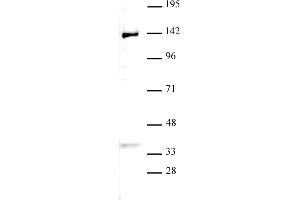 JMJD2B / KDM4B antibody (pAb) tested by Western blot.