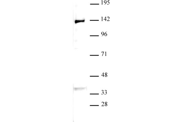 KDM4B Antikörper  (C-Term)