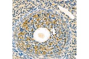Immunohistochemistry (Paraffin-embedded Sections) (IHC (p)) image for anti-Stem-Loop Binding Protein (SLBP) antibody (ABIN7075733)