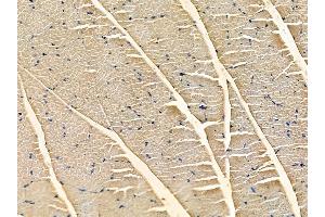 ABIN6262822 and ABIN6272335 at 1/100 staining rat muscle tissue by IHC-P. (KCNJ5 antibody  (N-Term))