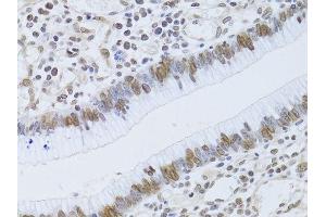 Immunohistochemistry (Paraffin-embedded Sections) (IHC (p)) image for anti-Lamin B2 (LMNB2) (AA 341-620) antibody (ABIN6143268)