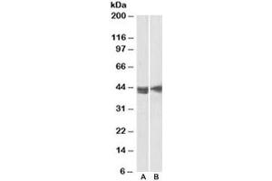 Western blot testing of Jurkat [A] and MOLT4 [B] lysates with CD123 antibody at 2ug/ml. (IL3RA antibody)