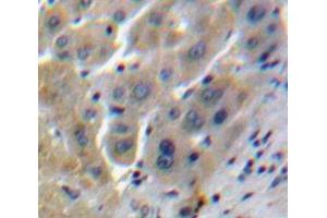 IHC-P analysis of Liver tissue, with DAB staining. (Clusterin antibody  (AA 228-449))