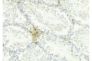 ABIN6274454 at 1/100 staining Mouse testis tissue by IHC-P. (AKAP1 antibody  (Internal Region))
