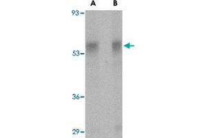 Western blot analysis of PLXDC1 in rat liver tissue lysate with PLXDC1 polyclonal antibody  at (A) 0. (PLXDC1 antibody  (Internal Region))