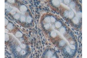 IHC-P analysis of Human Stomach Tissue, with DAB staining. (COL3A1 antibody  (AA 1059-1466))