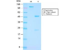 SDS-PAGE Analysis Purified FOLH1 Rabbit Recombinant Monoclonal Antibody (FOLH1/3149R). (Recombinant PSMA antibody  (AA 232-433))