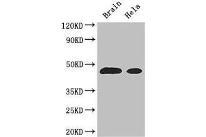 Western Blot Positive WB detected in: Mouse brain tissue, Hela whole cell lysate All lanes: ASS1 antibody at 3 μg/mL Secondary Goat polyclonal to rabbit IgG at 1/50000 dilution Predicted band size: 47 kDa Observed band size: 47 kDa (ASS1 antibody  (AA 168-222))