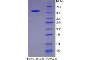 SDS-PAGE analysis of Pig ACE Protein. (Angiotensin I Converting Enzyme 1 Protein)