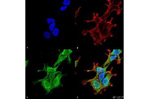 Immunocytochemistry/Immunofluorescence analysis using Mouse Anti-PINK1 Monoclonal Antibody, Clone S4-15 . (PINK1 antibody  (AA 112-496) (Atto 594))