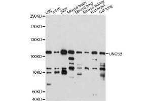 Western blot analysis of extracts of various cell lines, using UNC5B antibody (ABIN6291227) at 1:1000 dilution. (UNC5B antibody)