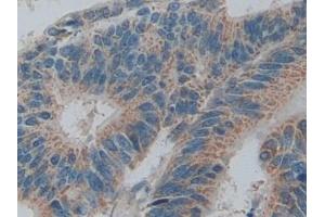 Immunohistochemistry (IHC) image for anti-SMAD, Mothers Against DPP Homolog 5 (SMAD5) (AA 210-464) antibody (ABIN7441760)