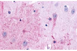 Anti-TACR3 antibody  ABIN1049390 IHC staining of human brain, neurons and glia.